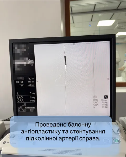 Був за крок до ампутації: на Волині лікарі врятували ногу пацієнта (фото)