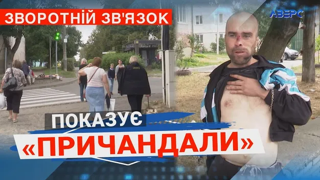 «Будеш моєю квіточкою»: психічно хворий лучанин шукає собі жінку – демонструє геніталії (відео)