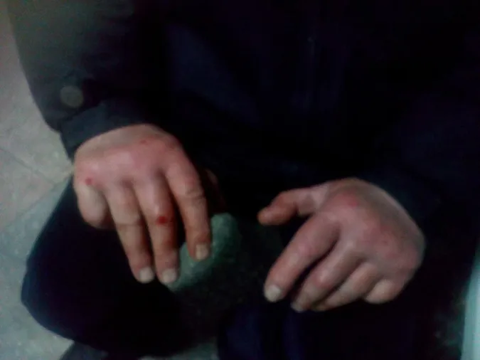 Попросили закурити і побили: в Луцьку вночі напали на дідуся
