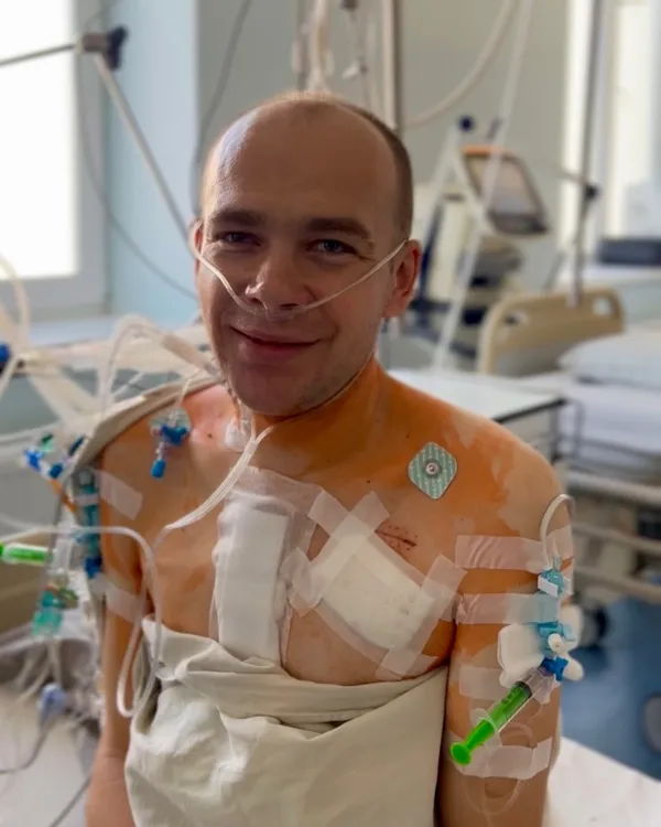 Нове серце для волинянина: у Львові провели унікальну операцію з порятунку чотирьох життів