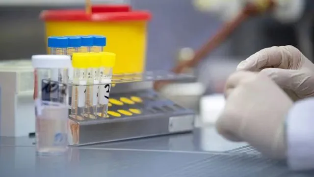 В Україні за добу – 656 нових випадків коронавірусу