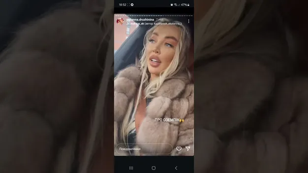 Відома лучанка Юліанна Дружиніна розповіла, як схудла та чи приймала «Оземпік» (відео)