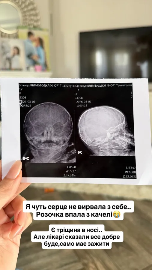 «Я ледь серце не вирвала»: однорічна донька блогерки Верби серйозно травмувалася (фото)