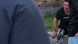 У Нововолинську чоловік жорстоко побив 21-річного воїна на протезі (відео)