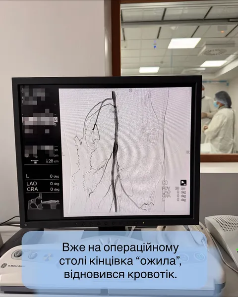 Був за крок до ампутації: на Волині лікарі врятували ногу пацієнта (фото)