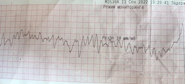 У Луцьку медики «швидкої» витягли з того світу 63-річного чоловіка (фото)