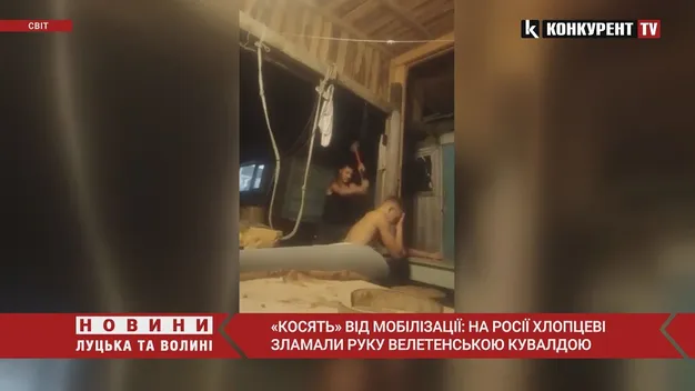 «Косять» від мобілізації: на росії хлопцеві зламали руку велетенською кувалдою (відео)