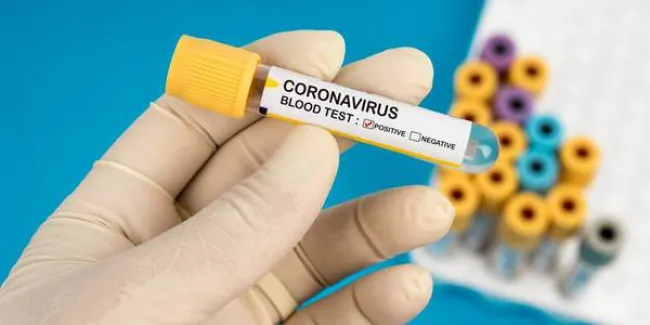 За добу в Україні 588 нових випадків COVID-19, на Волині – 27