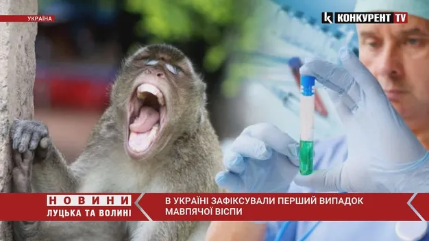 ❗️ В Україні виявили перший випадок інфікування мавпячою віспою (відео)
