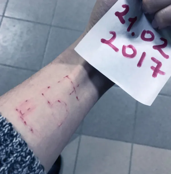 «Сині кити» у Луцьку: вся правда у масштабному розслідуванні  (фото, скріни)