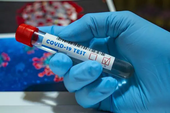 В Україні за добу – 2462 новІ випадки COVID-19, на Волині – 64