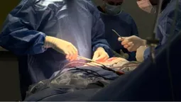 З голови маленького хлопчика з Волині видалили одну з найскладніших пухлин (фото)