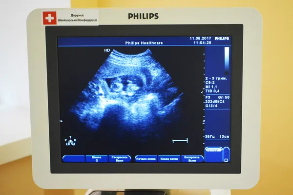 Ультразвуковий апарат Philips