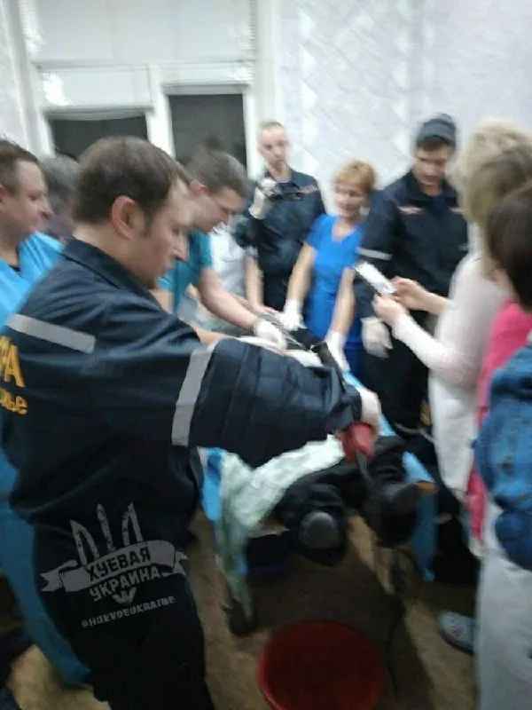 У Запоріжжі ревнива дружина накрутила чоловіку гайку на статевий член (фото 18+)