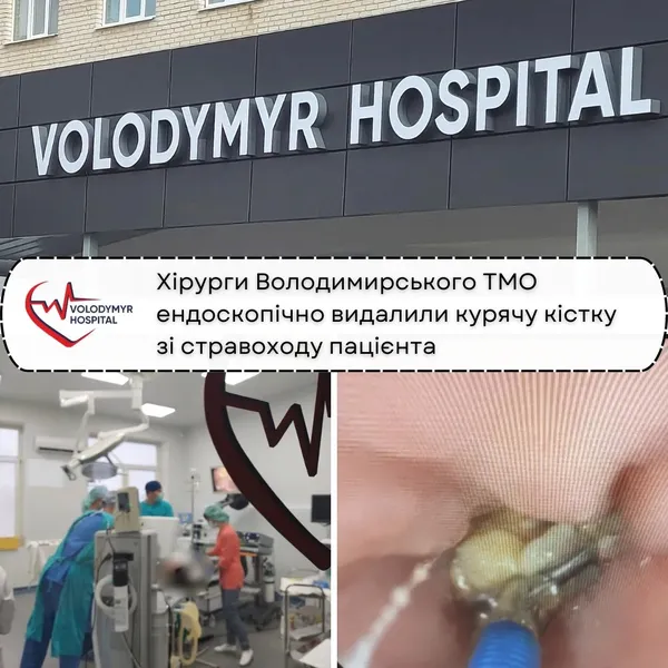 На Волині зі стравоходу чоловіка дістали курячу кістку (фото)