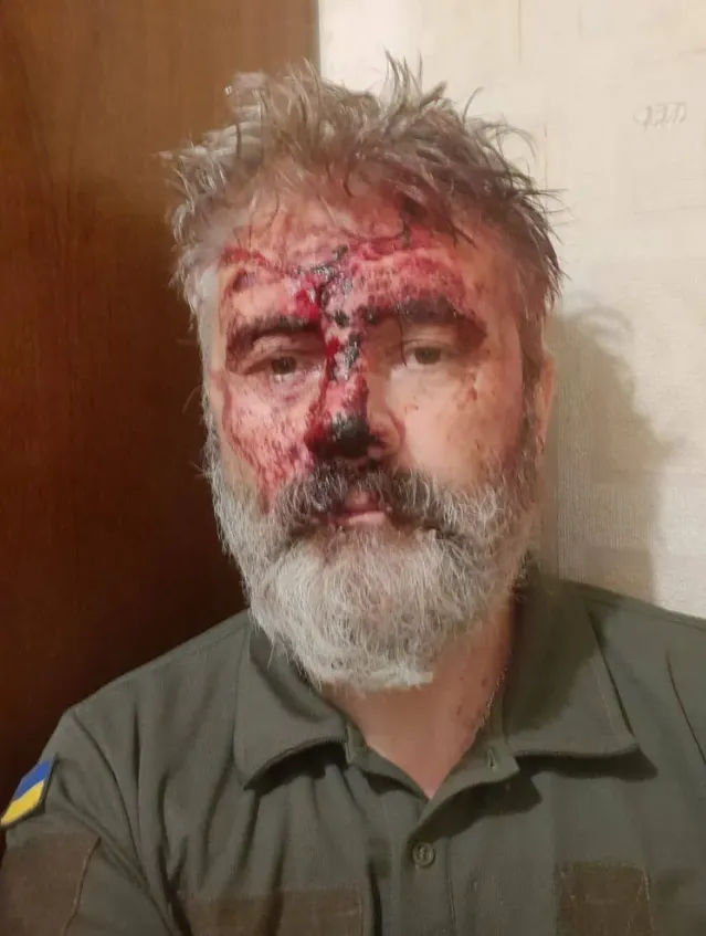 Митрополит Кримський Климент, якого побили в Києві