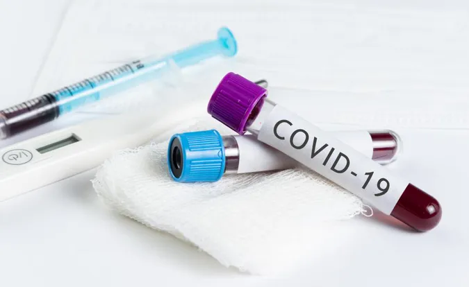 За добу в Україні – 7 517 нові випадки COVID-19, на Волині – 218