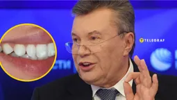 «Зробимо зуби, як у Януковича»: Київ «підірвали» бігборги стоматологічної клініки (фото)