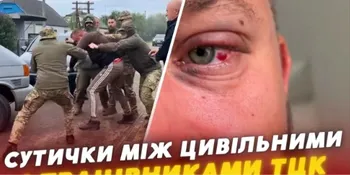 «Запшикали балончиком і душили»: на Волині ветеран заявив про побиття працівниками ТЦК (відео)
