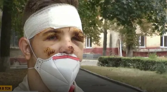 «Раптом отямився всередині палаючого літака»: єдиний курсант, який уцілів в авіатрощі Ан-26