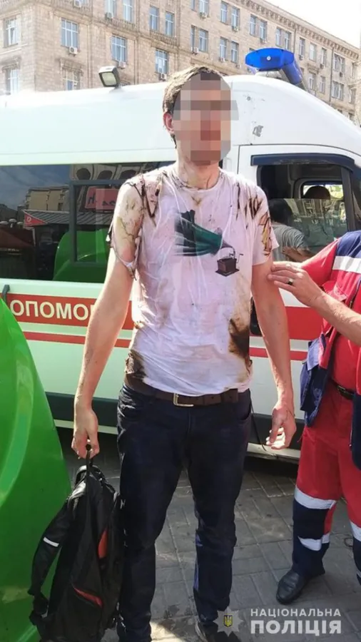 Під час урочистостей в центрі Києва чоловік підпалив себе