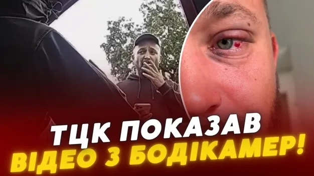 На Волині ветеран заявив про побиття групою оповіщення: у ТЦК показали відео з бодікамер (відео)