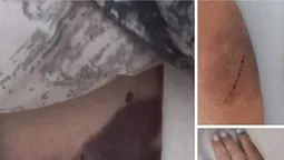 Син директора Рівненської АЕС побив жінку похилого віку,  – ЗМІ (відео)