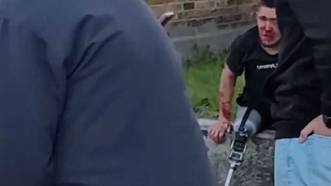 У Нововолинську чоловік жорстоко побив 21-річного воїна на протезі (відео)