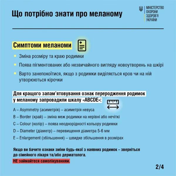 Рак, що виникає через надлишок сонця: у МОЗ розповіли,  як уберегтися від меланоми