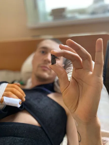 Поранений на фронті Юрій Гудименко розповів, як почувається (фото)
