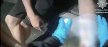 У Луцьку рятували юнака з закривавленою рукою (відео)