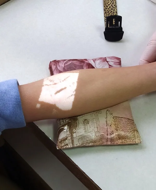 У дитячій поліклініці Луцька з’явився венозний сканер (фото)