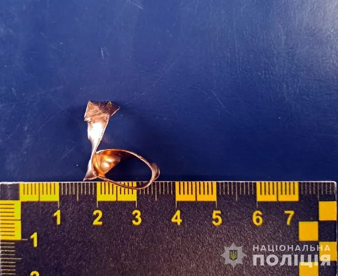 На Житомирщині працівник моргу плоскогубцями зрізав із пальця загиблого воїна обручку (фото)