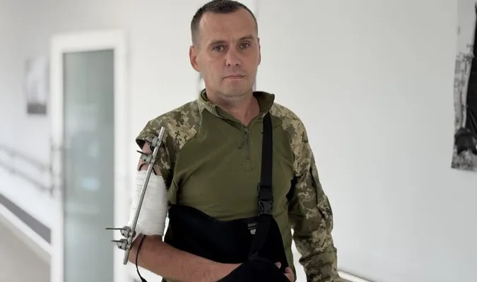 Кисть висіла, а пальці не рухались: як воїну з Волині рятують руку (фото)