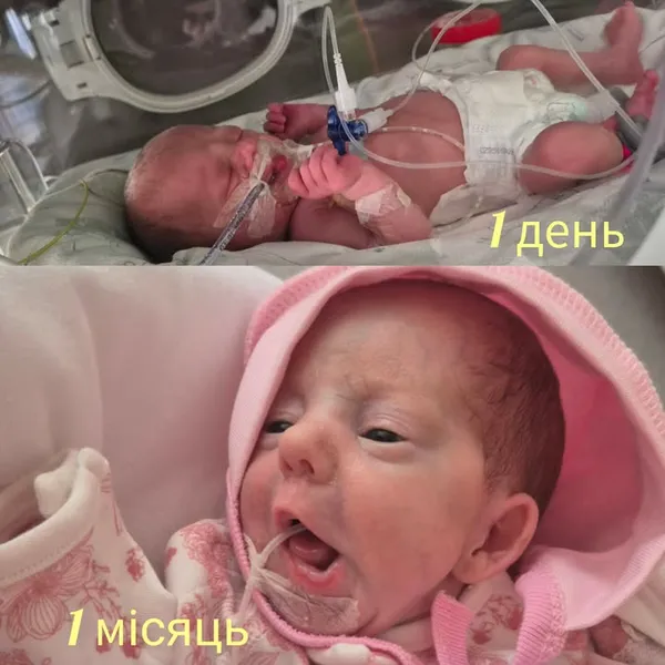 Стан був важкий: у Луцьку виходили крихітне немовля (фото)