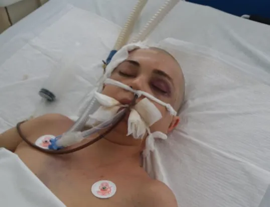 Поліція з'ясувала, чому померла побита лучанка