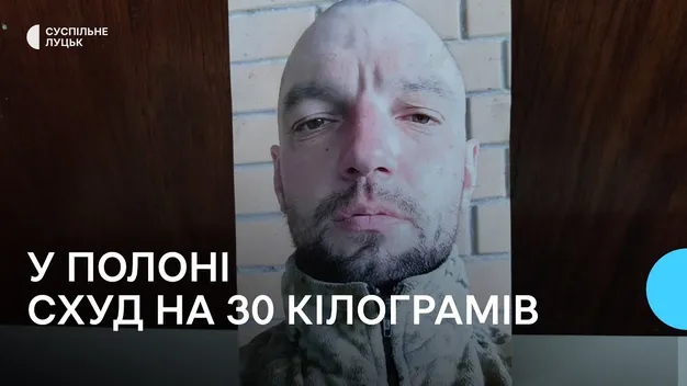 Схуд на 30 кг: звільнений з полону волинянин Анатолій Холевінський чекає на операцію