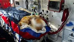 Волинські медики доставили до аеропорту в Польщі пацієнта з понад 36% опіків тіла (фото)