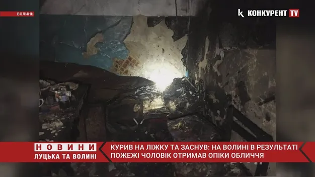 На Волині через необережне куріння чоловік отримав опіки обличчя (відео)