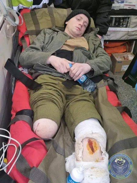 Репатріація: Україна передала РФ усіх важкопоранених полонених (фото)