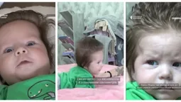 Малюк з Житомирщини народився з довжелезним волоссям (відео)