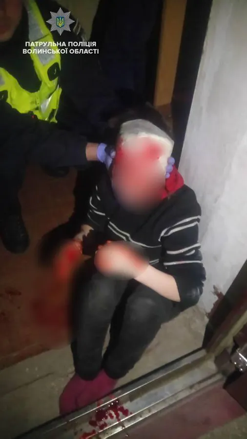 Проламали голову і покинули напризволяще: у Ковелі патрульні врятували жінку (фото, відео)