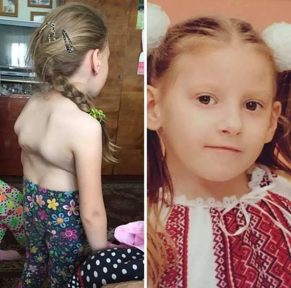 Лучан запрошують на благодійний концерт «Різдвяна зірка» (відео)