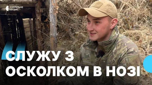 Як прикордонник Волинського загону продовжує службу з осколком в нозі  (відео)