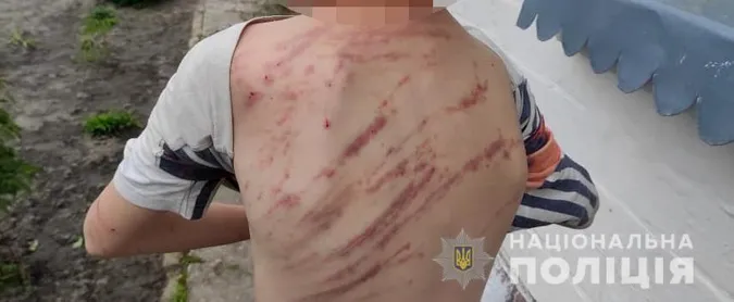 На Волині батьки побили підлітка у «виховних» цілях (фото)