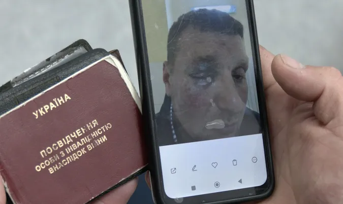 У Луцьку розслідують побиття ветерана працівниками ТЦК: деталі справи (фото, відео)