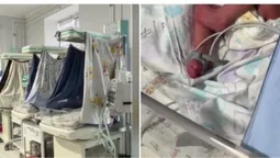 У Рівному жінка народила одну дитину з двійні та продовжує доношувати другу