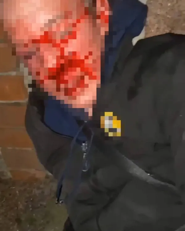Били і знімали на відео: на Київщині підлітки до напівсмерті відгамселили знайомого (фото 18+)