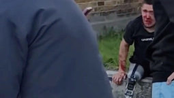 У Нововолинську чоловік жорстоко побив 21-річного воїна на протезі (відео)