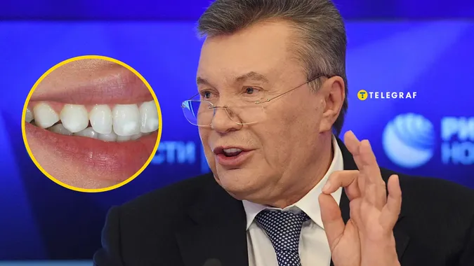 «Зробимо зуби, як у Януковича»: Київ «підірвали» бігборги стоматологічної клініки (фото)